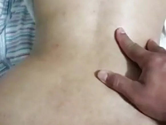 ଆନାଲ୍ ପ୍ରୋଲାପ୍ସ୍ ପତ୍ନୀ, ପତ୍ନୀଙ୍କ ଗଧ